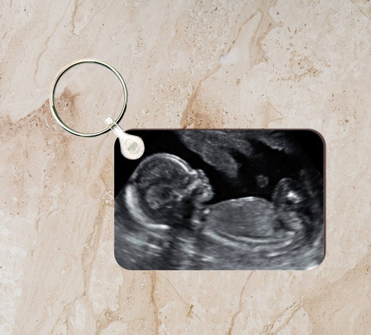 Baby Scan Photo Keyring